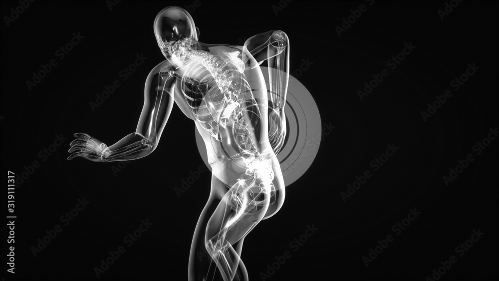 back pain relief