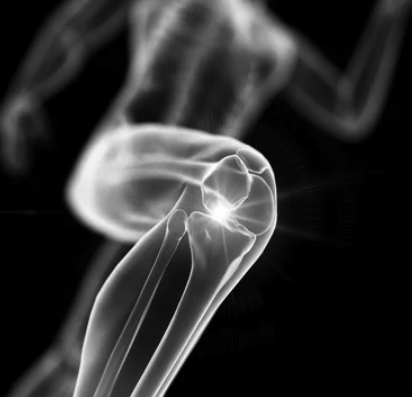 knee pain